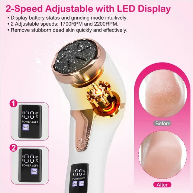 17Pcs Electric Foot Callus Remover